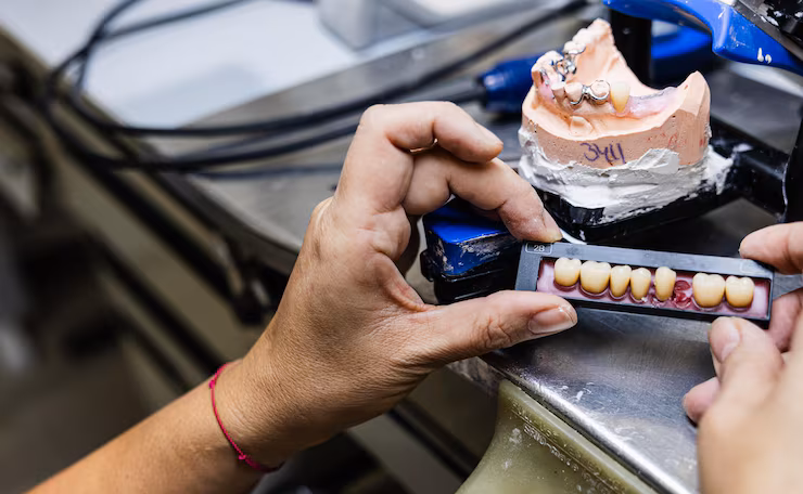 Hybrid Prosthesis - Fixed Implant-Supported Teeth in Bangalore