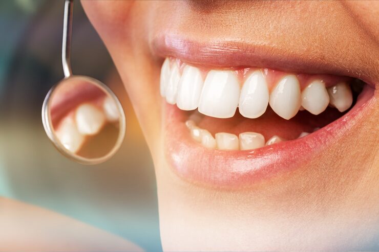 Tooth Whitening - Brighten Your Smile with Confidence